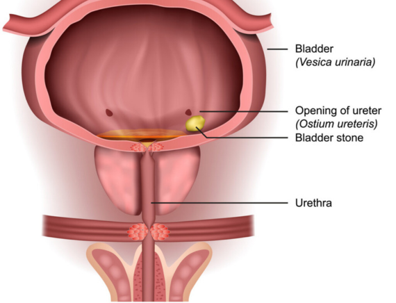 bladder