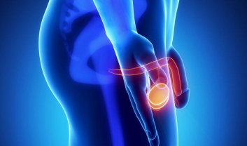 Testicular Cancer