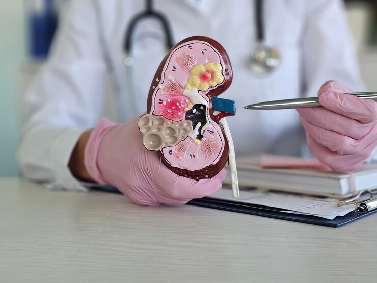 Best Ureteric Stones Treatment in Noida