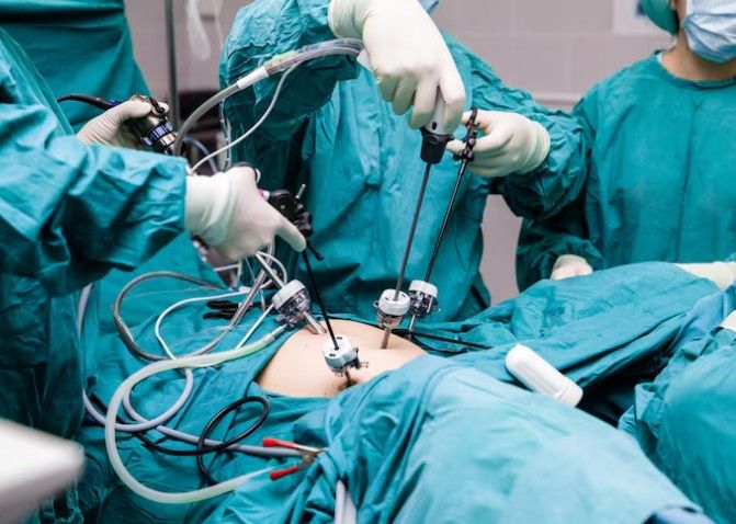 Doctors performing advanced laparoscopic surgery in Preet Vihar