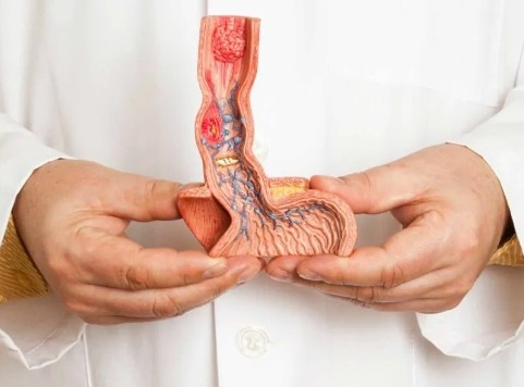 Best Doctor for Penile Cancer Treatment in Sector 39, Noida