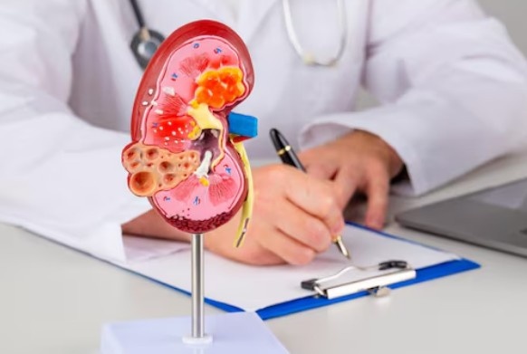 Best Urologist for Ectopic Ureter in Laxmi Nagar